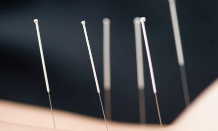 Up to 37% Off on Acupuncture Services at Treasure Coast Community Acupuncture