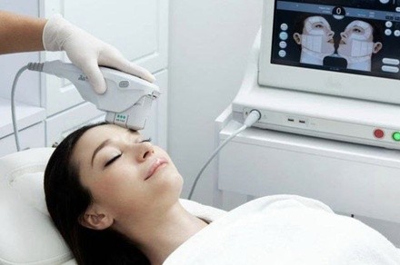 One focused ultrasound full face lift service or Non-Surgical Aesthetic Face Lift at Shape of You (Up to 67% Off)