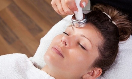 Up to 49% Off on Microdermabrasion at Surface Studios