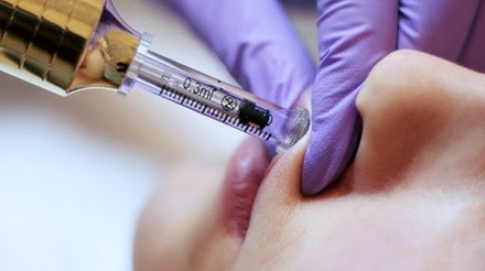 1 ml or 2 ml of Hyaluron Pen Lip Filler Treatment at Chapis Beauty & Body Contouring (Up to 35% Off)
