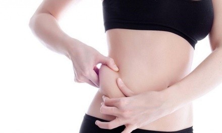 CryoShaping Session at CryoSalon (Up to 55% Off). Two Options Available.