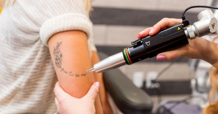 Six Tattoo-Removal Treatments for an Area of Up to Three or Six Square Inches at Couture Med Spa (Up to 84% Off)