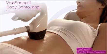 One Velashape III Session on One Medium or Large Area at Beauty Factory Spa (Up to 25% Off)