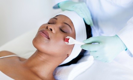 One or Two Microneedling Treatments at Jolie Spa (Up to 40% Off)