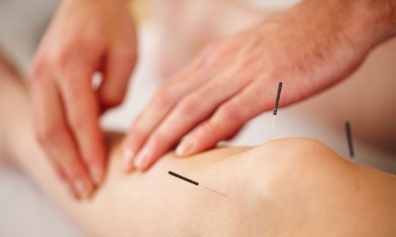 Integrative Acupuncture with Massage and Optional Two Sessions at Montes Rose Acupuncture (Up to 46% Off)