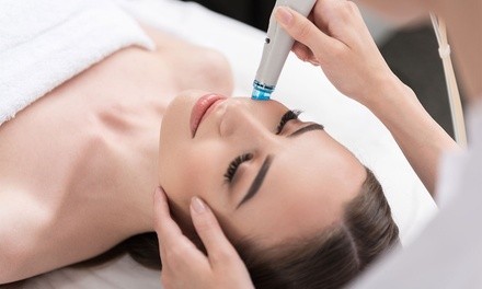 Up to 52% Off on Microdermabrasion at BerryHill Beauty