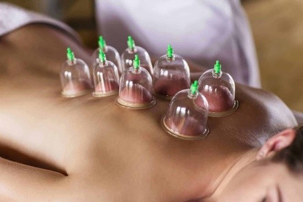 Up to 64% Off on Cupping at Family Tree Wellness