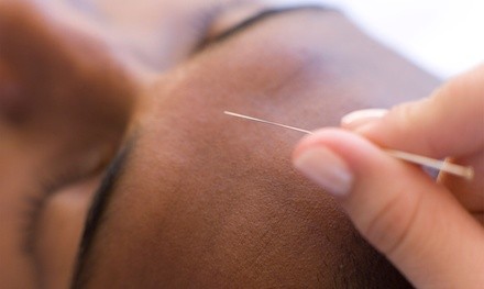 One or Two Acupuncture with Two Cupping Sessions at Park Healing Center (Up to 43% Off)