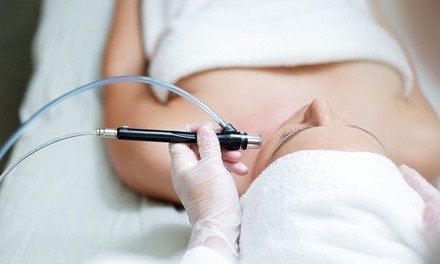 Diamond Microdermabrasion, Dermaplane, or Spa Facial at Hello BeYOUtiful Spa! (Up to 36% Off)