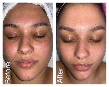 Up to 50% Off on Facial - Anti-Aging at Atx Esthetician Llc