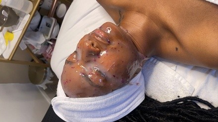 Up to 50% Off on Facial - Exfoliating at Celeste Luxe Aesthetics LLC