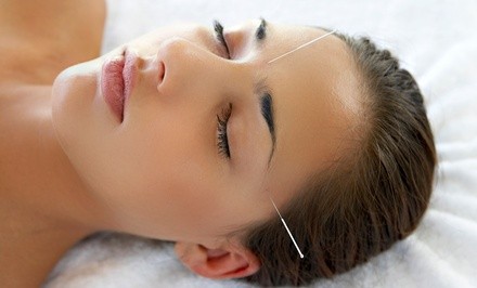 Up to 66% Off on Acupuncture at CN Acupuncture Clinic