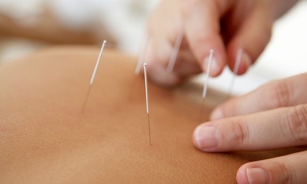 Up to 27% Off on Acupuncture at Oliver Acupuncture