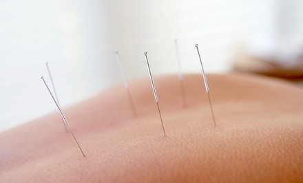 Up to 72% Off on Acupuncture Services at Connected Health