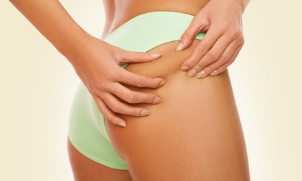 Three 80-Minute Cellulite Treatments at White Lotus Massage (Up to 35% Off). Two Options Available.