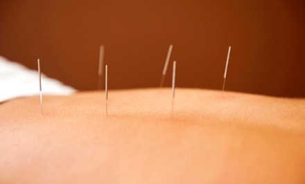 $35 for $50 Worth of Acupuncture — Westboro Acupuncture & Herbal Medicine