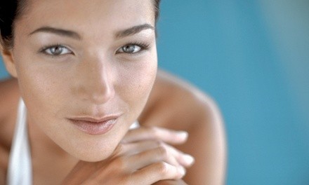 15- or 30-Minute Radio Frequency Facial at BodyLift Houston (Up to 31% Off)