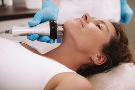 Up to 54% Off on Radio Frequency Skin Tightening at Babe Body Sculpt