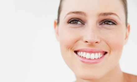 $26.40 for $1,000 Towards Dental Implants at Design Dental Spa