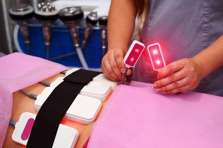 Up to 66% Off on Liposuction - Non-Invasive Laser (iLipo) ​at Babe Body Sculpt