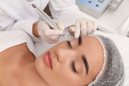 Up to 61% Off on Tattoo Removal at Timeless Beauty by Norma