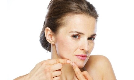 One or Three Acne Facials with Microdermabrasion at Skincare 212 (Up to 59% Off)