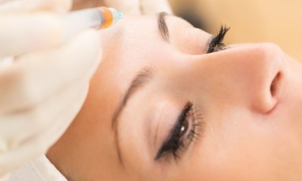 $189 for 20 Units of Botox at Silvergate Medical Center and Medical Spa ($240 Value)