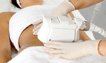Two, Four, or Six Fat Freezing Treatments at New Image New Life Spa (Up to 64% Off)