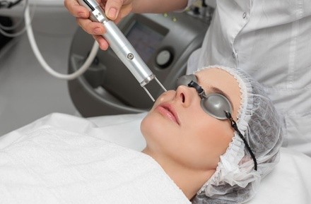 One or Three CO2 Laser Skin-Resurfacing Treatments at Beauty Spa Soho (Up to 64% Off). Six Options Available.
