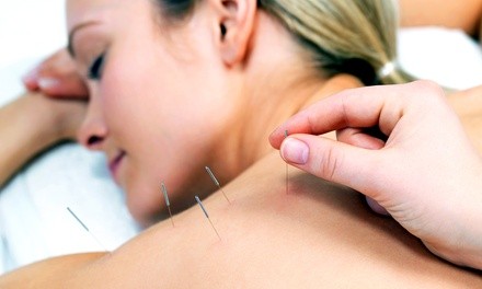 $44.25 for a Consultation and Three Acupuncture Sessions at Premier Alternative Health Center ($205 Value)