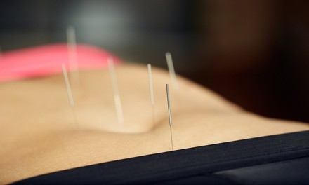 One or Two Acupuncture Treatments with Initial Consultation at ARC Health Center (Up to 54% Off)