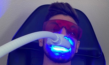 LED Teeth Whitening at Beaming Brilliance (Up to 50% Off). Four Options Available.