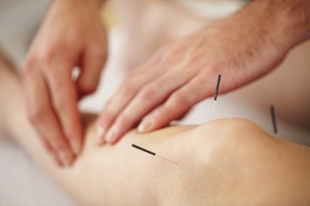 Up to 59% Off on Acupuncture at Bloom Medical Inc