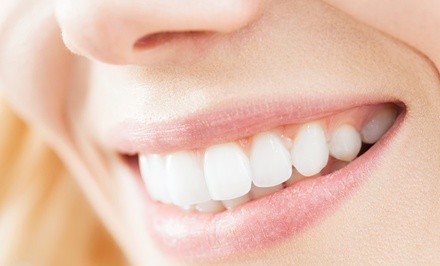 Up to 79% Off on Dental Checkup at Hulen Smiles