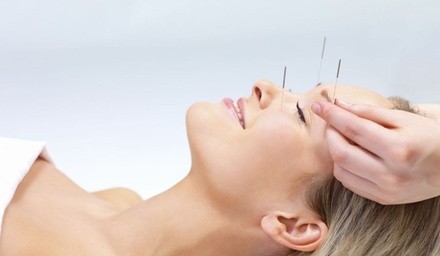 Up to 80% Off on Acupuncture Services at Joyee Acupuncture & Herbs