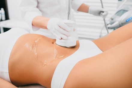 Up to 74% Off on Cavitation at Queen's Luxury Aesthetics