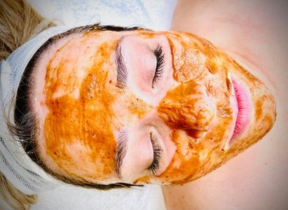 Up to 28% Off on Facial - Fruit Acid Peel at Skin By Aisha