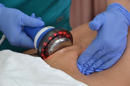 Up to 67% Off on Fat Reduction - Non-Branded at Aesthetics Beauty Laser