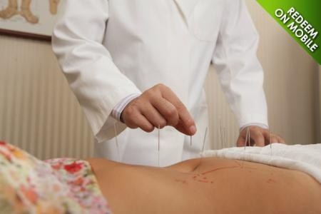 $63 for $125 Worth of Acupuncture — One Holistic Health Clinic