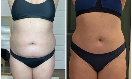 Up to 47% Off on Cavitation at Build A Bitch Aesthetics