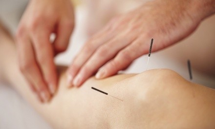 $52 for Consultation. Exam and Acupuncture Treatment at SoCal Neck and Back Injury Center ($75 Value)