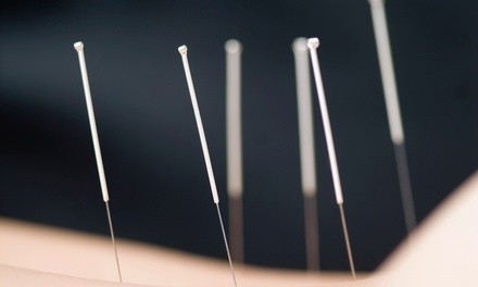 1 Acupuncture Session with Consultation, or 3 Sessions at Shang's Acupuncture & Laser Therapy (Up to 87% Off)