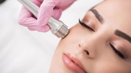 Up to 46% Off on Microdermabrasion at Violet James Esthetics