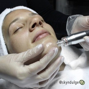 Up to 52% Off on Facial at Skyndulge