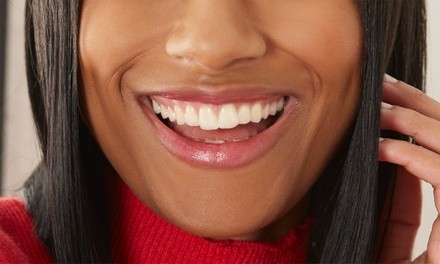 $52 for Teeth-Whitening Session at Heavenly Bodies Studios ($75 Value)