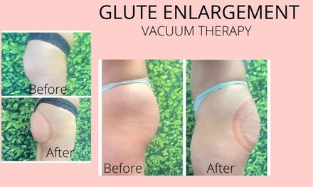 Up to 42% Off on Nutrition / WeightLoss Consult at Everythingbeauty.___