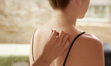 One Acupuncture Treatments at New Height Acupuncture (Up to 48% Off)