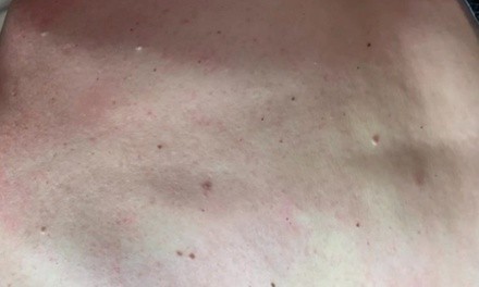 Up to 40% Off on Sugaring at Emesty