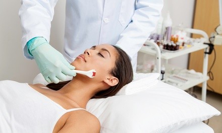 One Microneedling Treatment w/ Stem Cell or Medical-Grade VI Peel at Allure Medical Aesthetics (Up to 30% Off)