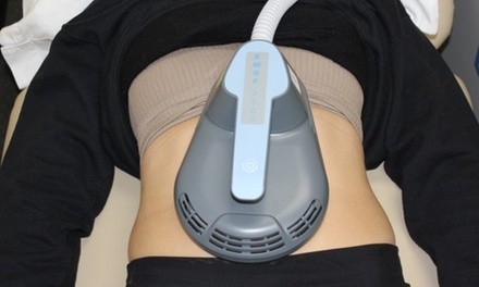 $2,400 for EMRF 3000 Fat-Loss and Muscle-Toning at Bridgeport Sculpt and Tone ($4,000 Value)